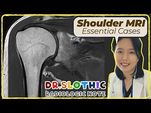 Shoulder MRI in Real Practice: From Rotator Cuff to Instability | Core Cases