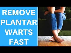 Remove Plantar Warts With Apple Cider Vinegar