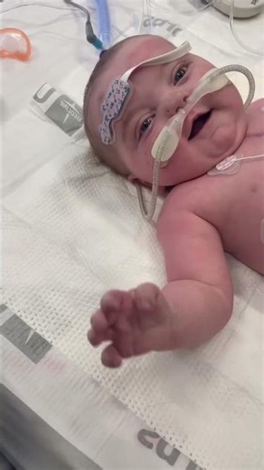 Our Little Warrior’s First Game of Peek-a-Boo! 👶✨