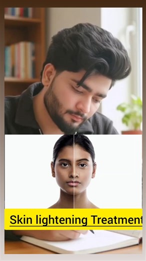 Pharmacist on Instagram: "✨ Skin Brightening Treatment – Safe & Effective Care ✨... Healthy skin ka matlab sirf fair nahi, even tone, glow aur damage-free skin hoti hai 🌿 ✔️ Causes treat karo – pigmentation, tanning, acne marks ✔️ Gentle cleansers & sunscreen daily ✔️ Doctor-recommended serums (Vitamin C, Niacinamide) ✔️ Chemical peels / medical facials (expert guidance mein) ✔️ Diet, hydration & proper sleep bhi zaroori ⚠️ Steroid & instant fair creams se bachें – ye skin ko permanent damage k