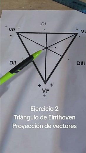 How does the vector projection look on all leads? Einthoven's Triangle