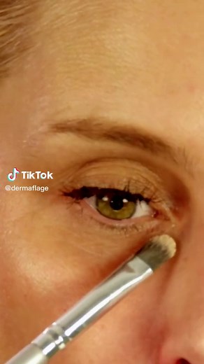 Dark circles GONE! Dermaflage color corrector with viramin K. #colorcorection #darkundereye #darkcirclesundereyes #darkcircles #dermaflage