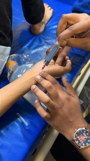 Radial ABG Sampling #medical #hospital #nursing #doctor