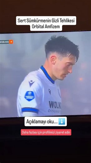 👍Takipte Kal, Bilgi Al👍 | Futbolcunun sümkürürken başına gelen durum, tıbbi literatürde Orbital Amfizem olarak adlandırılan bir olaydır. . Göz çevresindeki kemikler... | Instagram