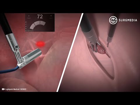 Robotic Drop-in Gamma Probe for Radioguided Surgery of Lymph Nodes