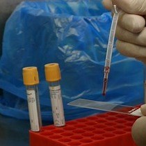 Video: Rapid Identification of Gram Negative Bacteria from Blood Culture Broth Using MALDI-TOF Mass Spectrometry