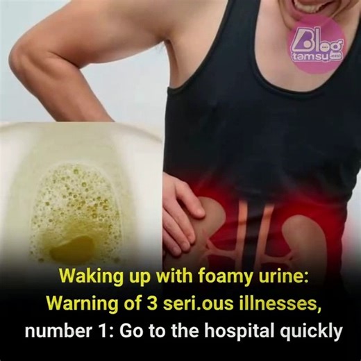 633K views · 730 reactions | Foamy urine in the morning? It could signal 3 dang.erous diseases—one of them requires an urgent hospital visit! | Likenow | Facebook