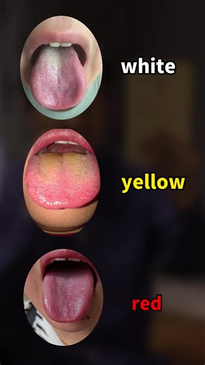 #sleepbetter #dailywellness #healthyhabits #tonguecheck #preventivehealth