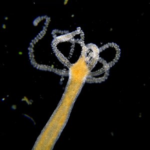 35K views · 576 reactions | When prey hits the hydra’s tentacle a neurotoxin is released that immediately paralyzes the victim. The hydra will then slowly contract its arms and transport the prey towards its mouth to be eaten alive! #MicroscopicMonday 匿  by My Microscopic World | Science Channel | Facebook