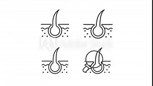 Hair damage animation set. Haircare animated line icons. Scalp health. Follicle dryness, breakage. Black illustrations on white background. HD video with alpha channel. Motion graphic
