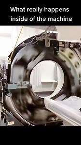 The CT scan technology always blows my mind 🤯🤯🤯 #ctscanner #cttechnologist #cttech #healthcarehumor #healthcareworker #medicalhumor #nursesoftiktok #ernurselife #icunurselife #xray #radiologytechnologist #radtechlife #xraystudent #neuronurse | Xray Girl Creations