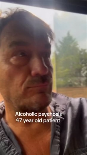 Scott Freda on Instagram: "Yes, heavy, long-term alcohol abuse can definitely cause severe brain damage leading to conditions like Alcohol-Related Dementia (ARD) (or Alcohol-Related Brain Damage, ARBD), which impairs memory, judgment, and thinking, and can also trigger psychological issues, including paranoia, as part of alcohol-induced psychosis or chronic mental health problems"
