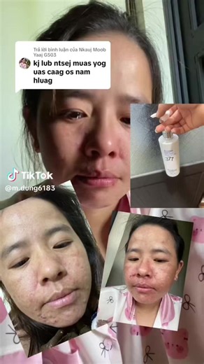 377 sữa rửa mặt không tốt: cách nhận biết và lựa chọn an toàn