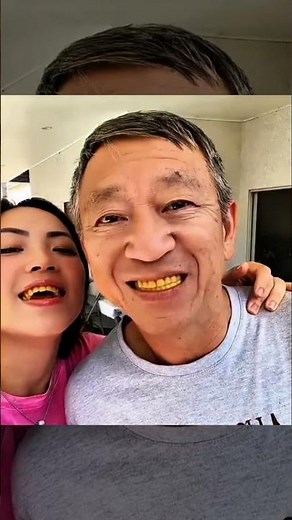 Yellow teeth filter pranks🔥🤯😱@/trollface/shorts@/trending/shorts@/edit/shorts@/usa/shorts