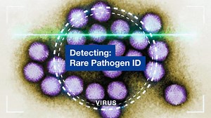 29 reactions · 7 comments | For the last 10 years, UCSF Department of Laboratory Medicine researchers, led by Charles Chiu, MD, PhD, have beta-tested a new way to ID rare and new pathogens, and they say it's ready for use worldwide. It could speed treatment for patients with brain diseases and sound an early alarm for the next pandemic. Credit: Chiu Lab https://tiny.ucsf.edu/mCFT4N | UCSF | Facebook
