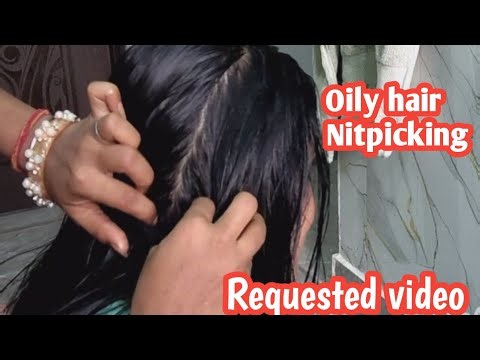 “Nitpicking with Oily Hair 😍 | Requested Relaxing Hair Care ASMR 💆‍♀️”✨