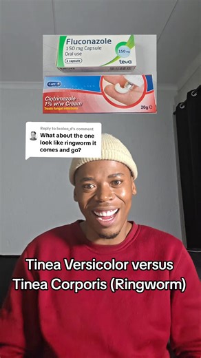 2K reactions · 91 shares | Tinea versicolor versus Tinea corporis...