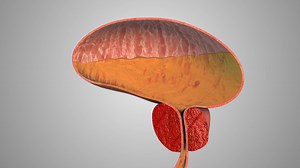 What is Benign Prostatic Hyperplasia (BPH)?