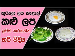 කුරුලෑ ලප කැළැල් කළු ලප ඉවත් කරගන්න හරි විදිය| Kurule Walata Beheth | Pimple Treatment Sinhala