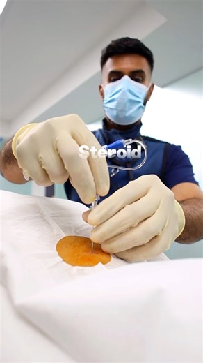 46K views · 190 reactions | Cervical epidural steroid injections are...