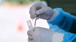 COVID tests: Tight supplies for rapid kits, plenty for lab exams