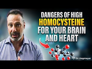 Homocysteine and Dangers of High Levels🩸- Here's Everything You Need To Know || Dr Richard Hagmeyer