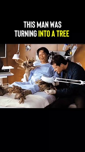 Tree Infection Human Transformation Scene