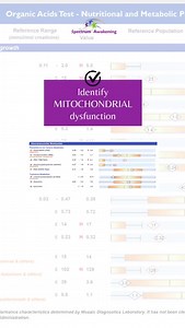 The infamous OAT test. An extremely comprehensive analysis of vitamin levels, mitochondrial function, brain chemistry metabolism, and intestinal infections. Now with Heavy Metals, Minerals, and Omega Fat Levels. All with a simple urine collection and finger stick! Don't guess, when you can TEST! Save 25% off with coupon code Autism25 now-4/8/24! spectrumawakening.com Your test results will come with an interpretation and supplement recommendations from Dr. Skowron. | Spectrum Awakening
