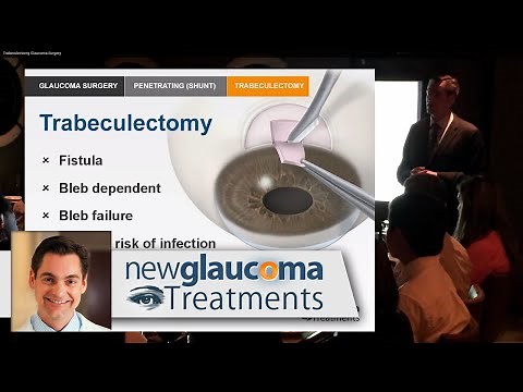 Trabeculectomy Glaucoma Surgery