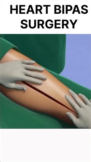 How Doctors Perform Heart Surgery?