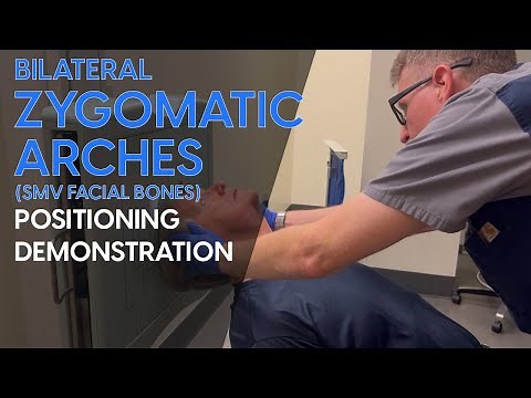 Bilateral Zygomatic Arches (SMV Facial Bones) Radiographic Positioning Demonstration