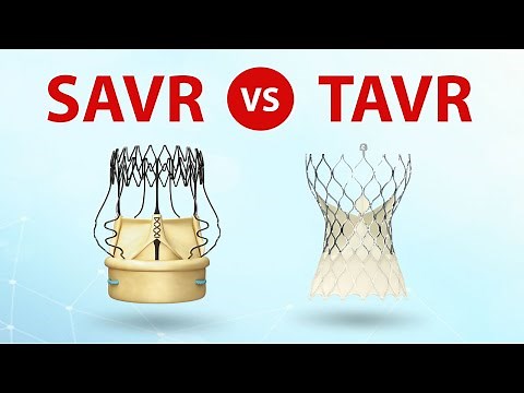SAVR vs. TAVR Patient Webinar: What Should Patients Know?