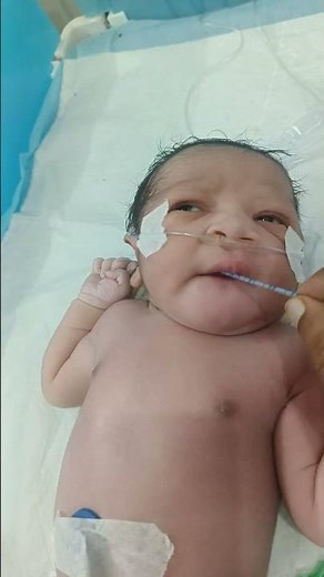 NICU Baby Gets Feeding Tube: A Look Inside Neonatal Care #FeedingTube #NeonatalCare #PrematureBaby