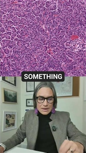 What are Acinar Cells in Pancreas