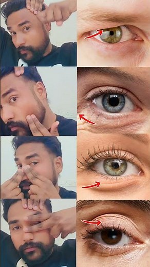 Get Rid of Eye Bags Naturally 👁️ | 4 Face Yoga Exercises for Under Eye Wrinkles & Dark Circles Fast