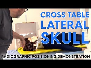 Cross Table Lateral Skull for Trauma