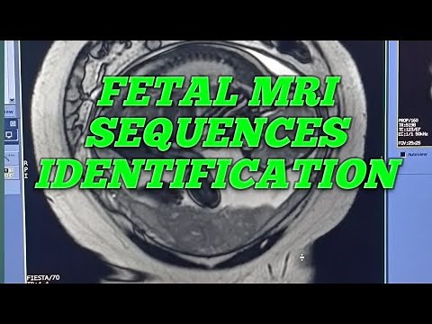 MRI FETAL SEQUENCES WITH INDENTIFATION @FETAL MRI SEQUENCES