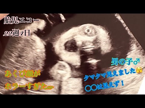 【妊娠6ヶ月(22週4日)】胎児エコーでタマタマ見えました【第二子】