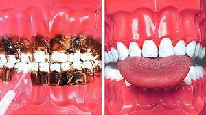 52K views · 208 reactions | Brush your teeth healthy! Everyday habits for your health you should learn! | 5-Minute Crafts Like | Facebook