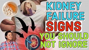 1.3M views · 4.9K reactions | Kidney Failure Signs You Should Not Ignore By Doctor Willie Ong (Internist & Cardiologist ) Check out our Tips: | Dr Willie Ong's Health Tips | Facebook