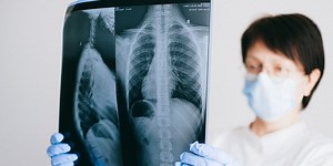 New "Dark-Field" X-ray Technology Improves Diagnostic Abilities for Pulmonary Conditions | Technology