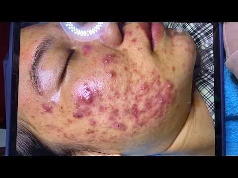 Enjoy Your Day with HANA Spa - Clinic #43