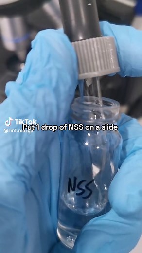 Stool Analysis Fecalysis: Step-by-Step Guide for Medical Technicians