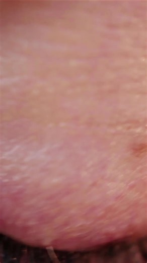 Natural Methods for Perfect Vision Restoration