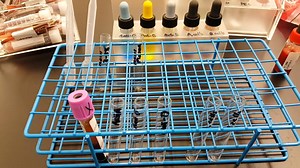 15K views · 229 reactions | ABO testing ❤️❤️ #lablife #medicallaboratoryscience | Lab life | Facebook