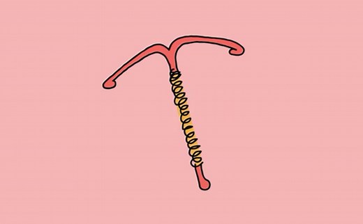 DIU: qué es, cómo funciona y a qué edad me lo puedo poner