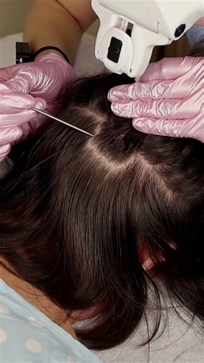 Ultimate ASMR Scalp Inspection with Hair Parting | Manual Skin Check #asmr #short #shorts