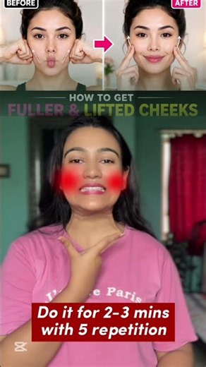 Face Yoga for Fuller & Lifted Cheeks Naturally ✨ | 5-Minute Cheek Exercise #Shorts