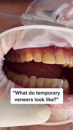 Tejas Patel, DDS on TikTok