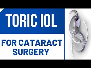 Toric IOL For Cataract Surgery